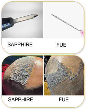 Sapphire FUE Blade